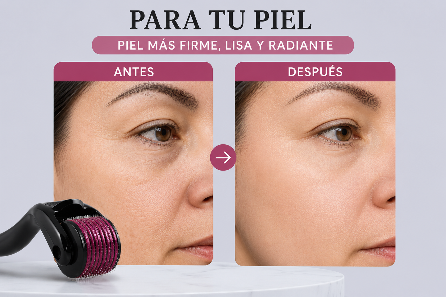 Derma Roller 540