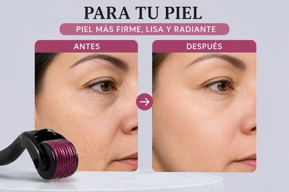 Derma Roller 540